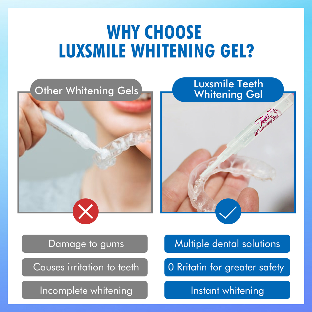 치아 미백 젤 PAP 또는 35%CP 치아 미백 젤 구 - Teeth Whitening Or Tooth Whitening 리뷰 및 가격