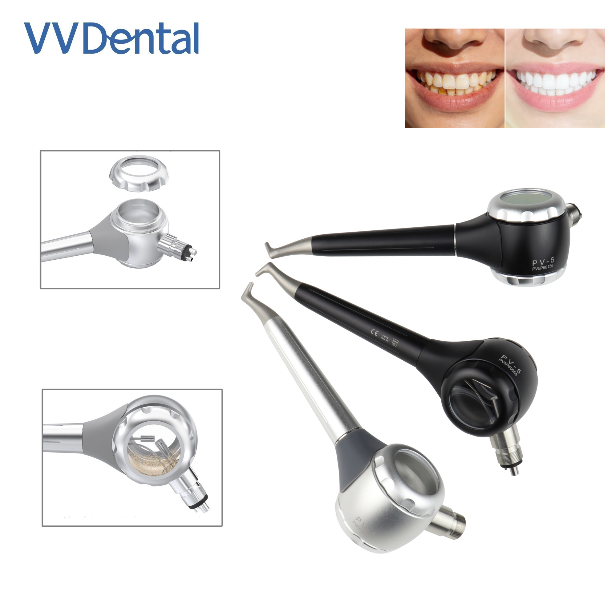 VV 치과용 2/4홀 치아 미백 샌드블라스팅 건 양면  - Teeth Whitening China 리뷰 및 가격