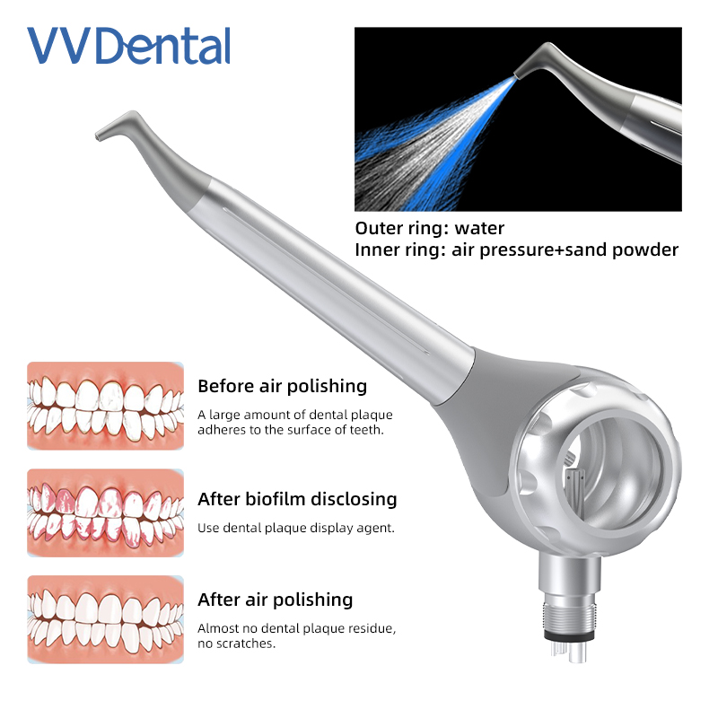 VV 치과용 2/4홀 치아 미백 샌드블라스팅 건 양면  - Teeth Whitening China 리뷰 및 가격