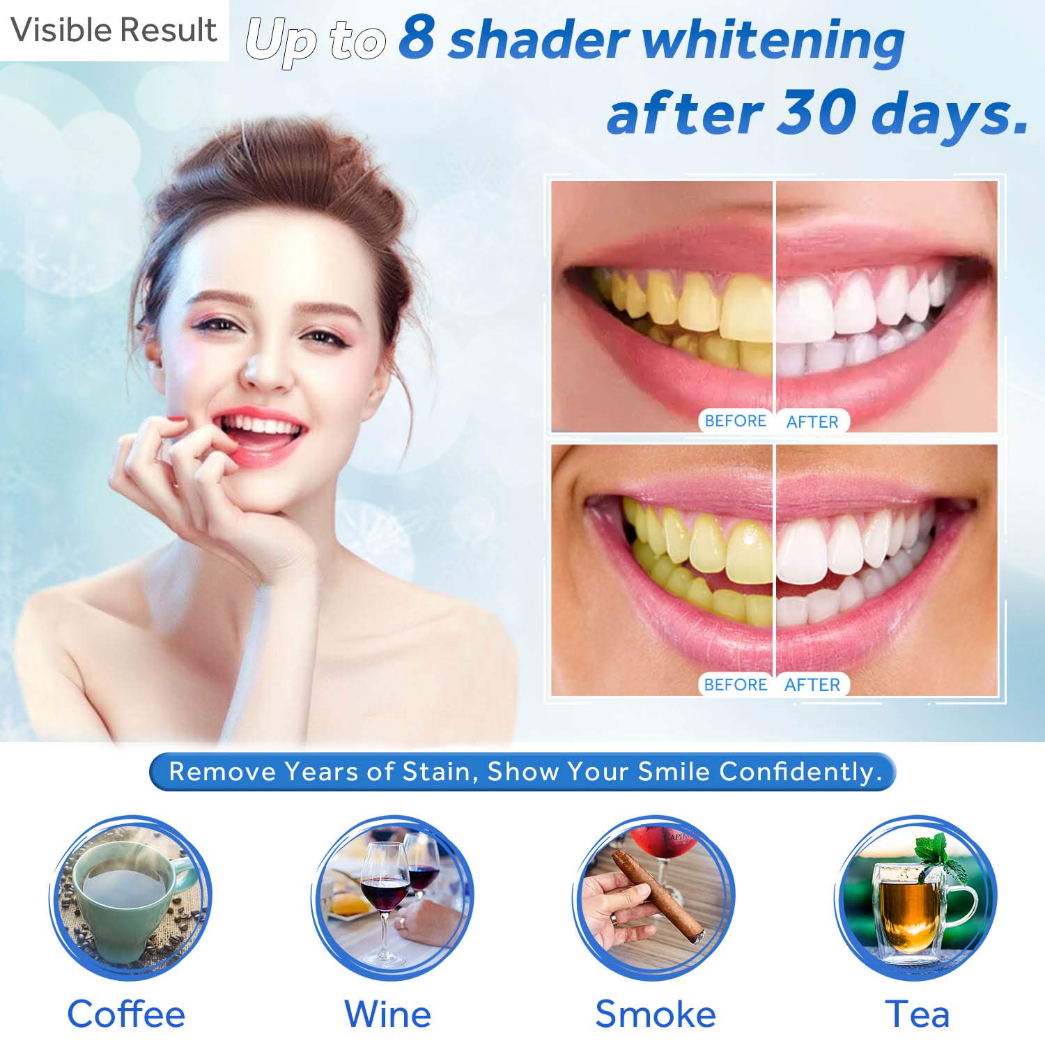 치아 미백 젤 리필 주사기 치아 미백 젤 인비스알라인  - Teeth Whitening Gel Refills 리뷰 및 가격