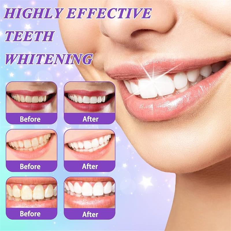 9D 퍼플 치아 미백 치약 무스, 누런 치아 및 플라그 - Teeth Whitening Best 리뷰 및 가격