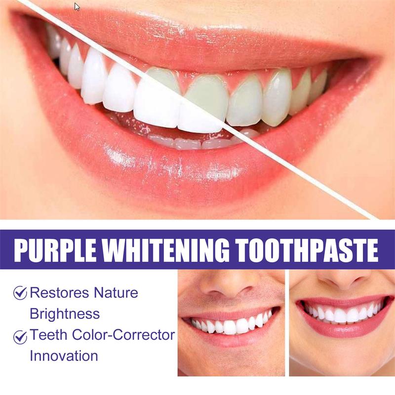 9D 퍼플 치아 미백 치약 무스, 누런 치아 및 플라그 - Teeth Whitening Best 리뷰 및 가격