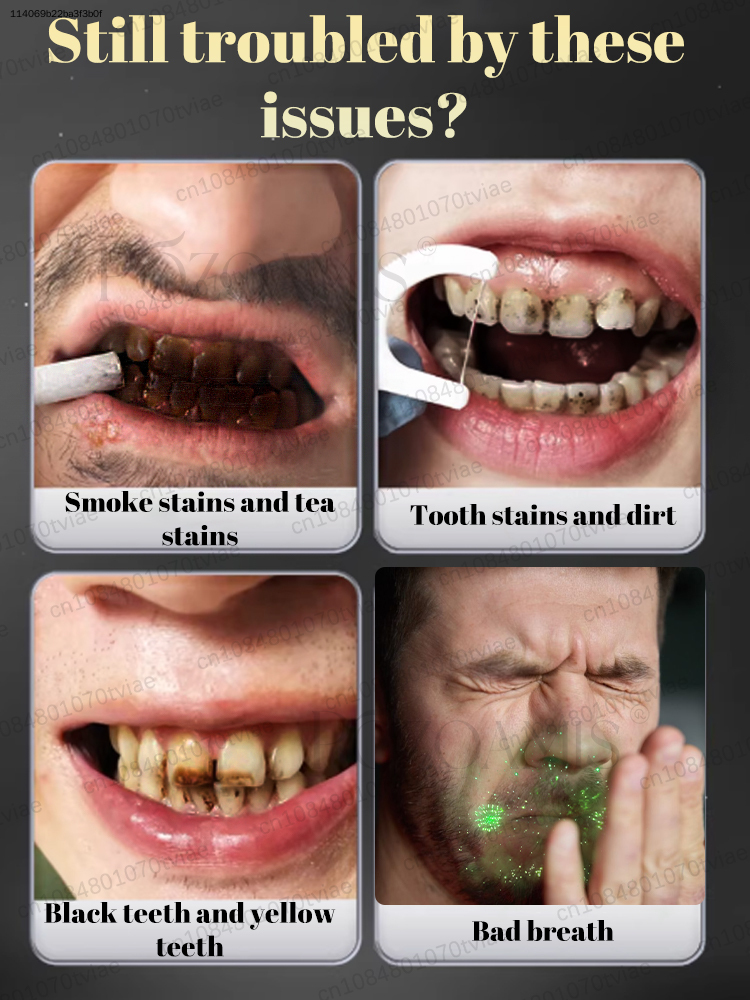 포조아미스 30% 하이드록시아파타이트 치약, 가정용,  - Teeth Whitening In Office 리뷰 및 가격