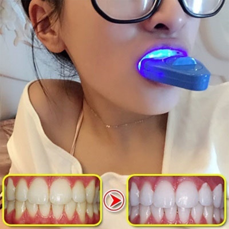 LED 치아 미백 라이트 미백 블루 라이트 UV 라이트 - Teeth Whitening Video 리뷰 및 가격