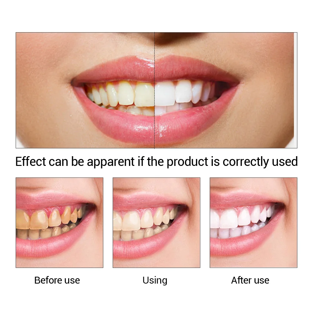 FTEENPLY 치아 미백 에센스 파우더 구강 위생 청 - Teeth Whitening China 리뷰 및 가격
