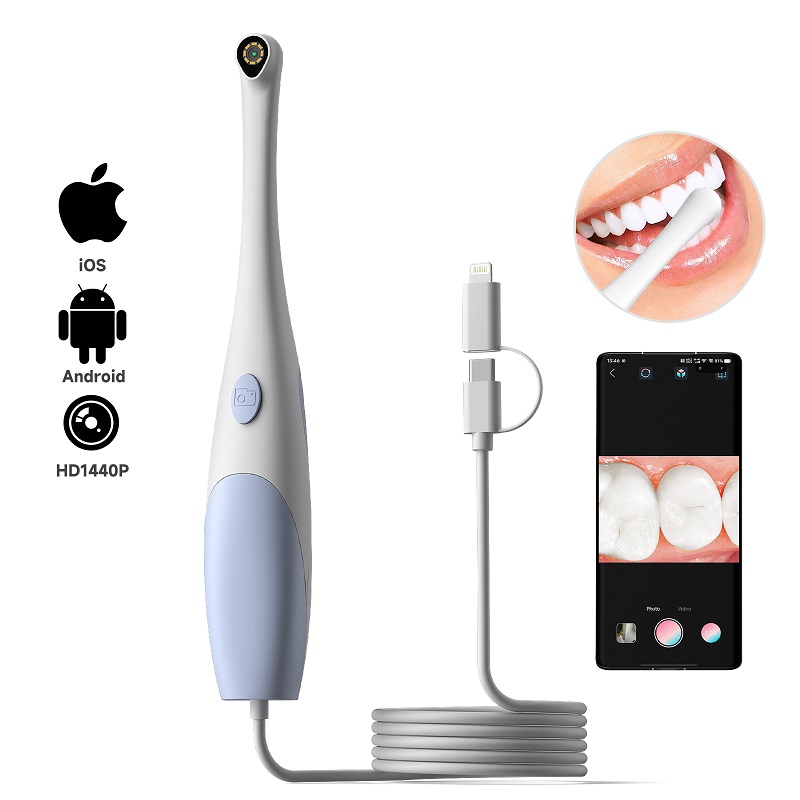 구강 내시경 카메라 1440P 사진 및 비디오 휴대용  - Teeth Whitening Video 리뷰 및 가격
