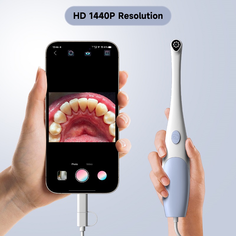 구강 내시경 카메라 1440P 사진 및 비디오 휴대용  - Teeth Whitening Video 리뷰 및 가격