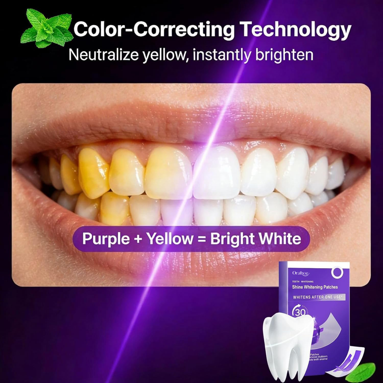 퍼플 치아 미백 콤보 키트 – 얼룩 제거 스트립 & 색 - Teeth Whitening In Office 리뷰 및 가격