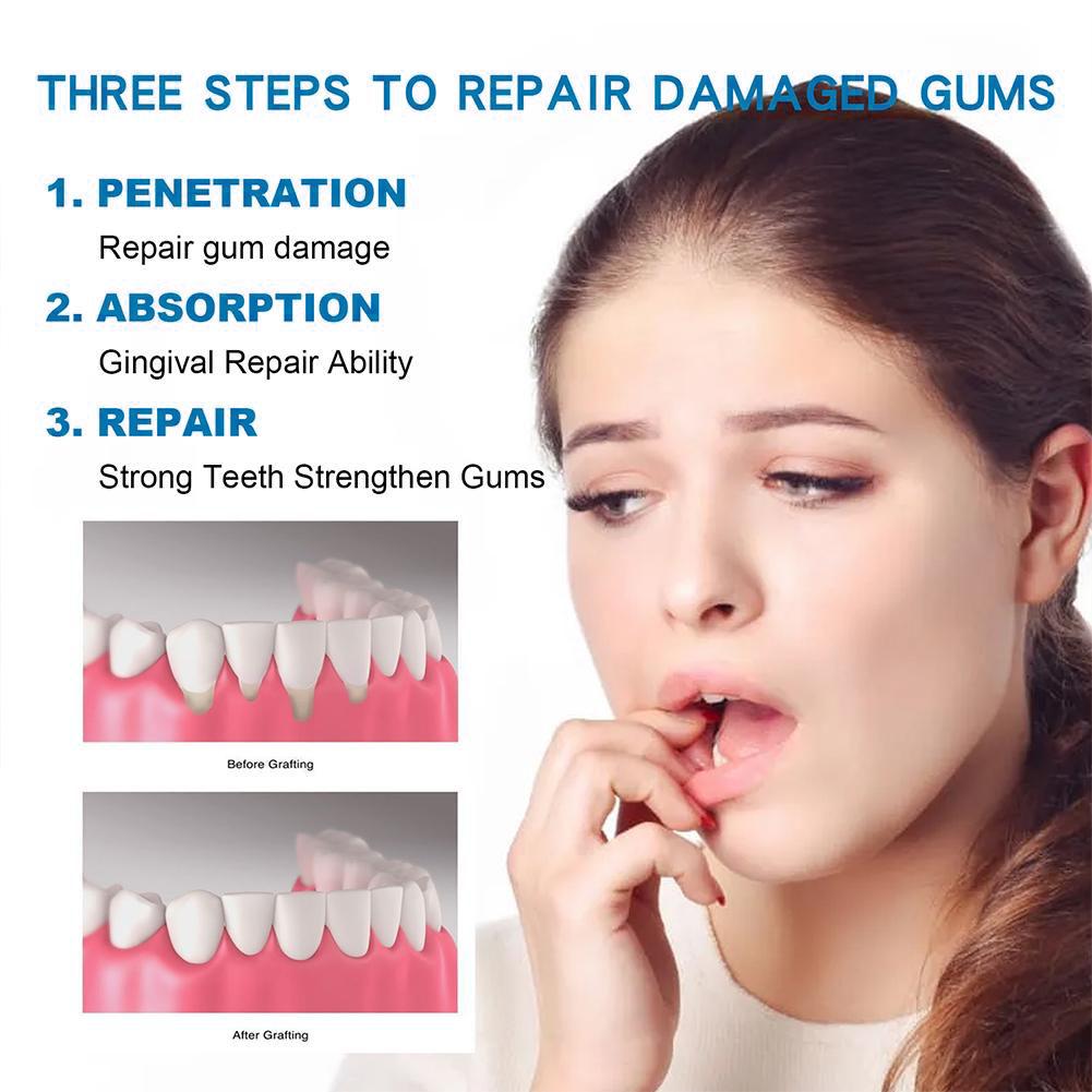치아 관리 치약 천연 잇몸 진정 치약 천연 치아 미백  - Teeth Whitening Best 리뷰 및 가격