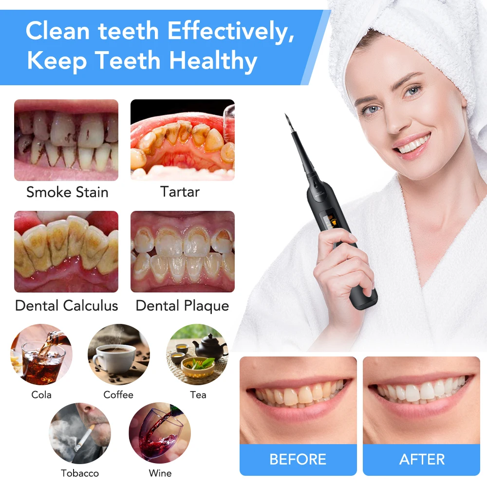 전기 치과 스케일러 칫솔 세트 LCD 화면 LED 라이 - Teeth Whitening Or Tooth Whitening 리뷰 및 가격