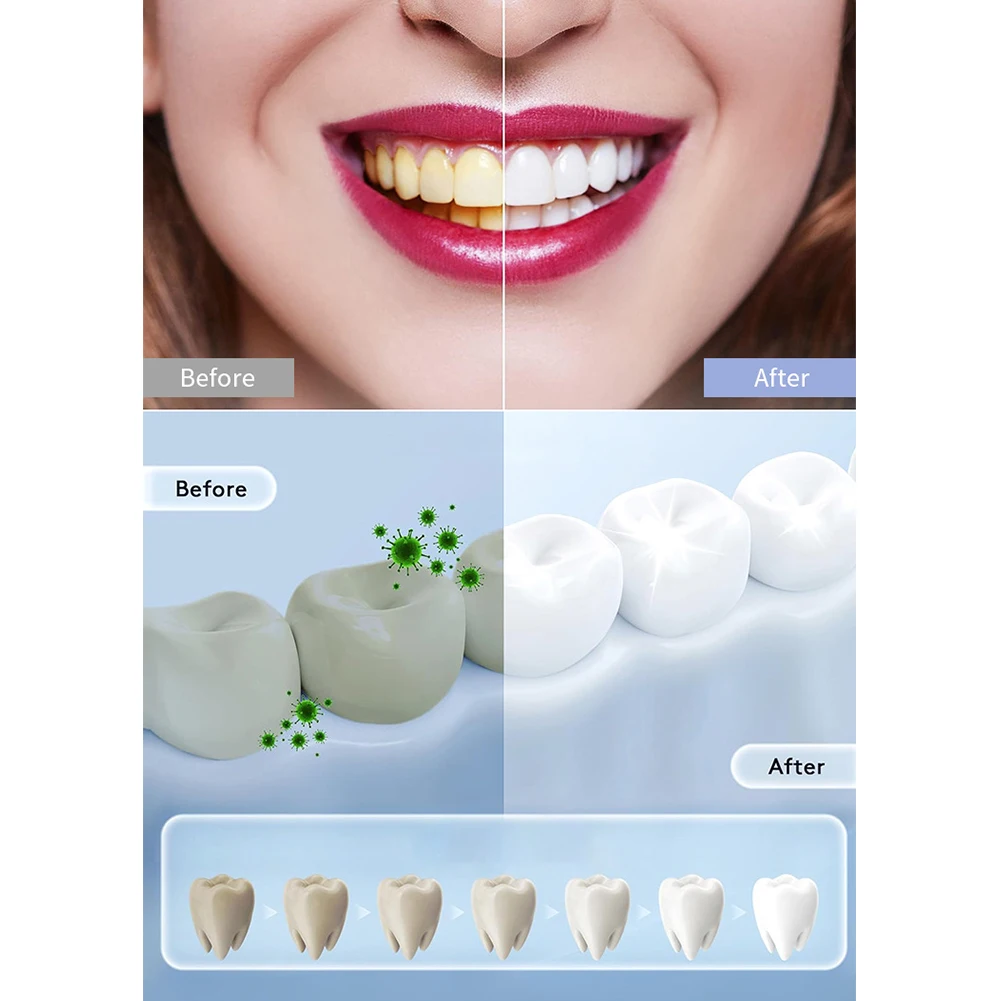 1개 가정용 스마트 LED 치아 미백 램프 휴대용 US - Teeth Whitening In Office 리뷰 및 가격