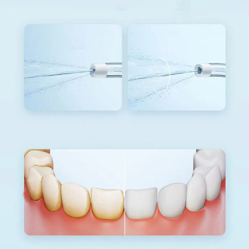 샤오미 휴대용 구강 세척기 F300 치과용 워터젯 워터 - Teeth Whitening Or Tooth Whitening 리뷰 및 가격