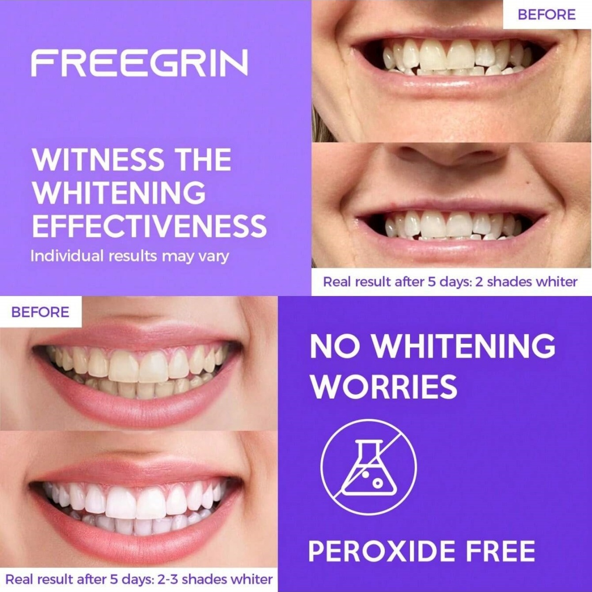 디럭스 화이트닝 치아 스티커 7/14/21 쌍 젤 화이 - Teeth Whitening Gel Refills 리뷰 및 가격
