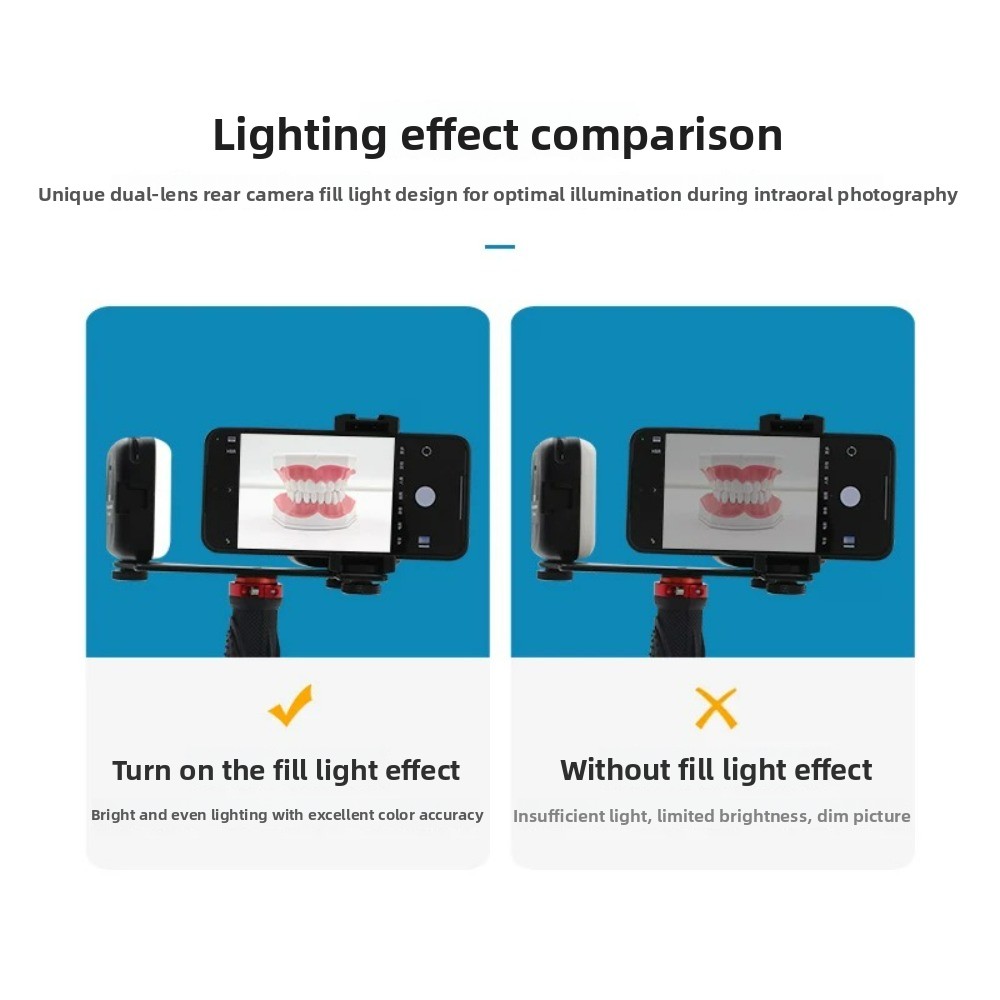 치과 사진 촬영 조명, 스마트폰용 블루투스 LED 플래 - Teeth Whitening Kit With Light 리뷰 및 가격