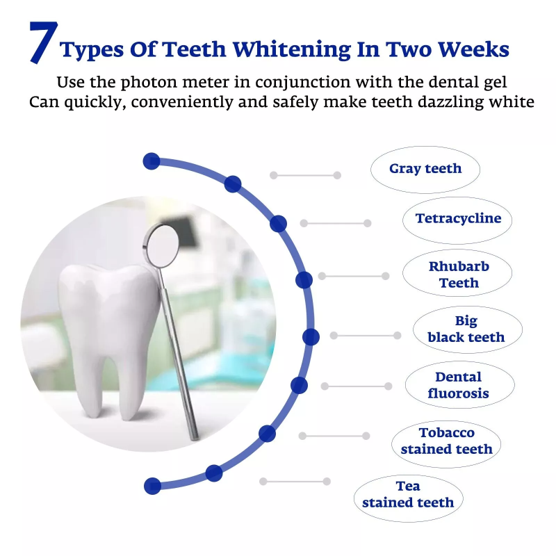 치아 미백 가속기 스마트 LED 블루 라이트 휴대용 U - Teeth Whitening Uv 리뷰 및 가격