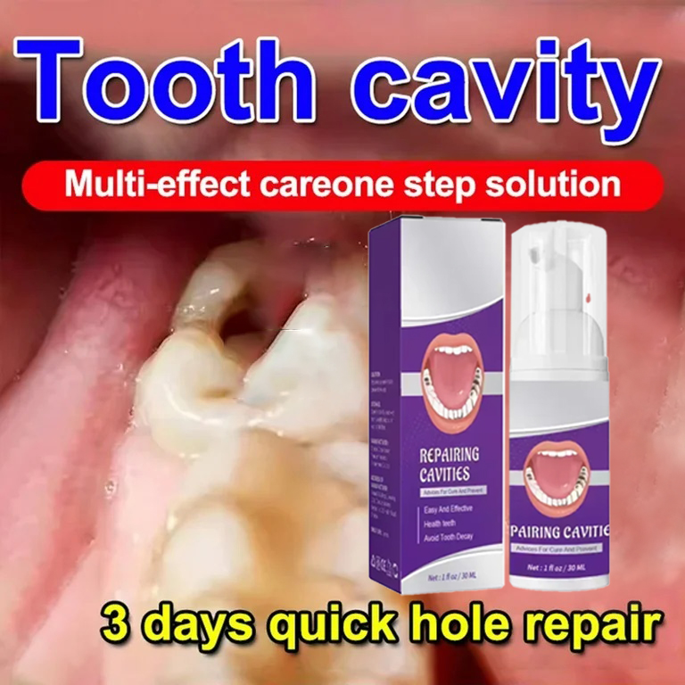 치아 청소 치약은 치아 얼룩을 제거합니다. 치아 미백  - Teeth Whitening Best 리뷰 및 가격