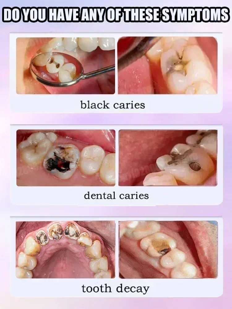 치아 청소 치약은 치아 얼룩을 제거합니다. 치아 미백  - Teeth Whitening Best 리뷰 및 가격
