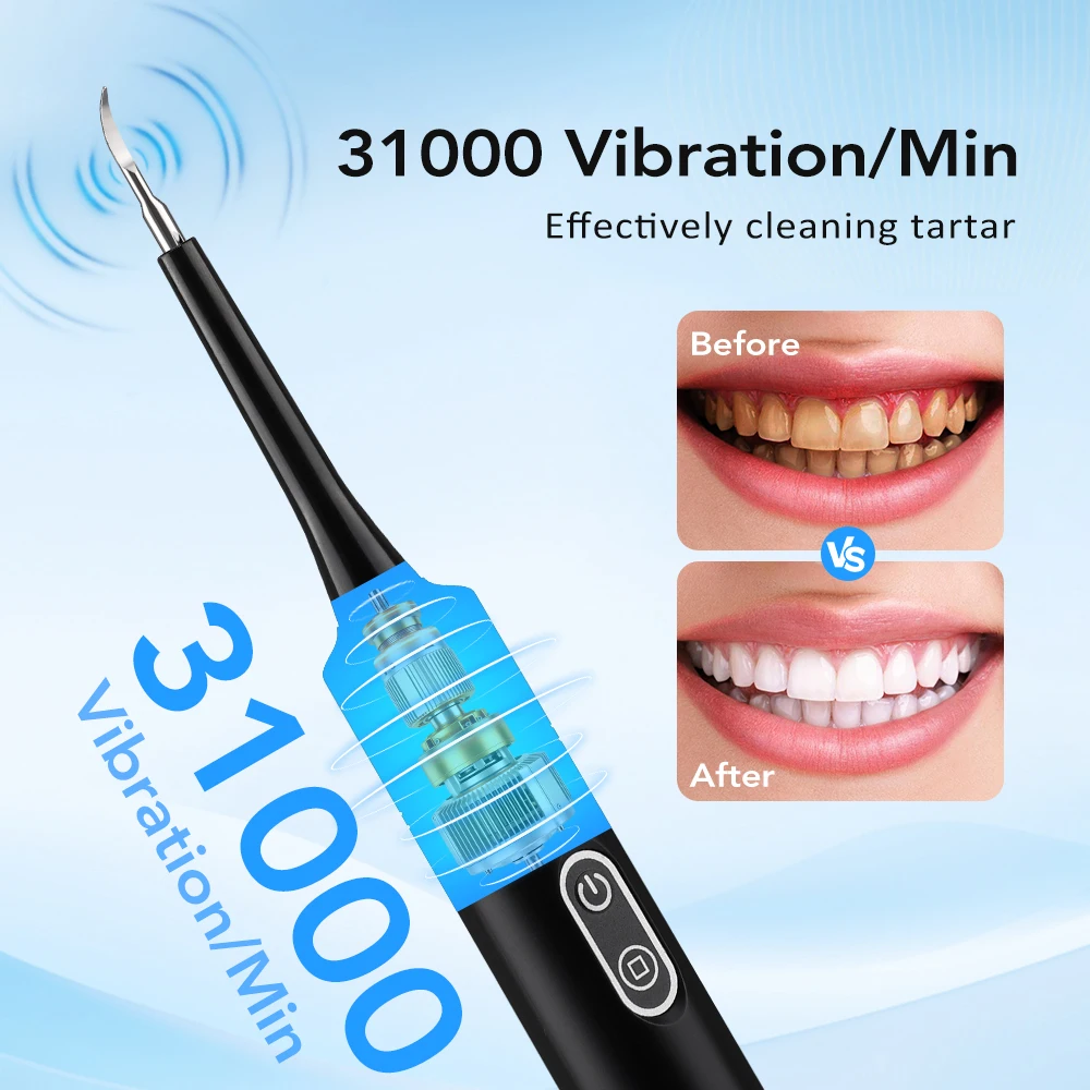 전동 음파 진동 치석 제거기 치아 미백 플라그 제거 치 - Teeth Whitening Home 리뷰 및 가격